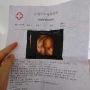 24周胎儿四维彩超（24周胎儿四维彩超数据）