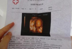 24周胎儿四维彩超（24周胎儿四维彩超数据）