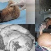 胎儿死在腹中的原因有哪些,胎儿死在腹中是什么症状