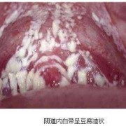 怀孕了白带有什么变化吗,孕期分泌物是什么样的图片