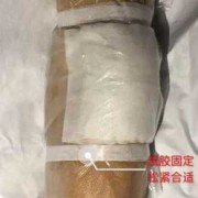 孕期阴部肿（孕期阴部肿胀如何使用硫酸镁敷）