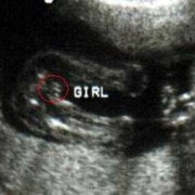 胎儿是什么（如果一个男生老是叫一个女生"妹妹""孩子"是什么意思）