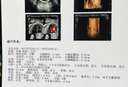 胎儿光片（胎儿光斑什么意思）