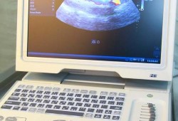 第一次产检为什么要做彩色多普勒超声常规检查,胎儿系统彩色多普勒超声检查 大排畸