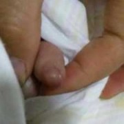 胎儿手指检查（胎儿手指检查多少钱）