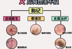 如何防止胎儿长胎记（如何防止胎儿长胎记的方法）