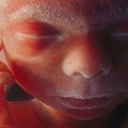 胎儿摄影（炫尼baby胎儿摄影）