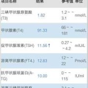 孕期tsh偏低（孕期tsh偏低说明什么）