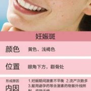 怎样消除脸上的妊娠斑,防止妊娠斑