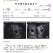 胎儿没胎心是什么原因，是什么原因导致的呢,胎儿无心跳是什么原因导致的