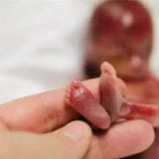 孕23周胎儿图片（孕23周胎儿图片欣赏）