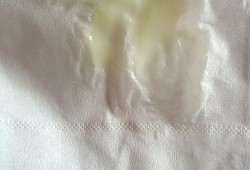 孕期白带黄浓（白带脓黄该怎么治疗）