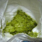 5个月宝宝大便水样绿色粘液样是怎么回事,五个月胎儿长多大了