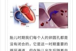 胎儿卵圆孔早闭（新生儿卵圆孔未闭怎么治疗）