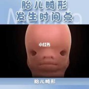 睡觉会把胎儿压畸形吗（胎儿会跟着母亲熬夜吗）