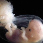 请问怀孕80天的胎儿应该有多大正常,胎儿发育完全手册图片