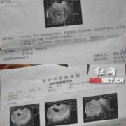 怀孕三个月做b超检查说宝宝爱动,怎么办,孕妇胎儿好动什么原因
