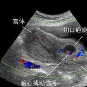 胎儿多少周刨腹产最好（胎儿多少周剖腹产最好）