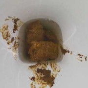 孕期憋不住屎（孕期憋不住屎正常吗）