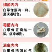 有滴虫严重吗滴虫是什么会有什么影响啊,孕妇滴虫会传染胎儿吗图片