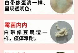 有滴虫严重吗滴虫是什么会有什么影响啊,孕妇滴虫会传染胎儿吗图片
