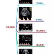 胎儿大脑中动脉意义（胎儿大脑中动脉意义主要看哪个数）