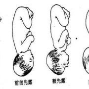 胎儿先露头是什么意思（胎儿先露头是什么意思）