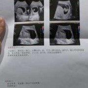 9周胎儿视频（孕9周如何判断胎儿正常，要做什么检查）