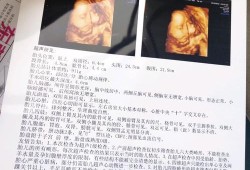 四维显示没有左肾可以要吗,胎儿没有肾能存活吗