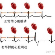 孕妇心脏早搏对胎儿有影响吗,胎儿早搏问题严重么