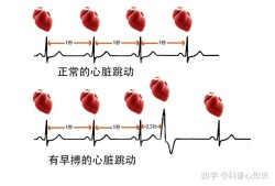 孕妇心脏早搏对胎儿有影响吗,胎儿早搏问题严重么