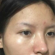 孕期皮肤出油（孕期皮肤出油厉害）