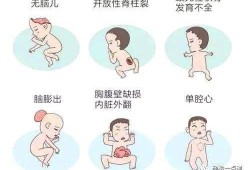 胎儿致死性畸形（胎儿致死性畸形）
