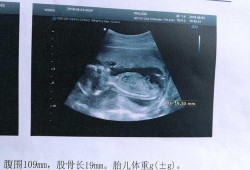 胎儿17周发育稳定了吗？正常多少周就稳定了呢,怀孕17周胎儿稳定了吗吃什么好