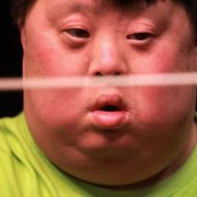 怀唐氏综合症胎儿症状（怀唐氏综合症胎儿症状有哪些）