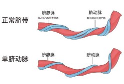 正常胎儿主动脉（脐带是什么样子的）