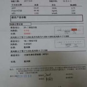 胎儿21三体综合征（胎儿21三体综合征高风险是什么意思）