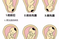 怀孕期间不小心碰到了腰，宝宝会受到影响吗,胎儿在腰部动什么胎位