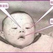 唐氏胎儿有什么表现,唐氏胎儿在母体的征兆