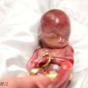 胎儿刚出生（胎儿刚出生能看见东西吗）