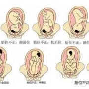 胎儿在肚子的左边还是右边（胎动在右边吗）