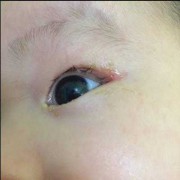 6个月胎儿图片（宝宝6个月了，眼睛还是有很多眼屎，怎么回事）