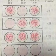 检测胎儿血型（孕期产检会对血型进行检查吗?一直都不知道自己是什么血型的，或者我可以自己处理呀）