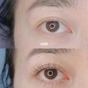 孕期可以种睫毛吗（孕期可以种睫毛吗有影响吗）