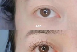 孕期可以种睫毛吗（孕期可以种睫毛吗有影响吗）