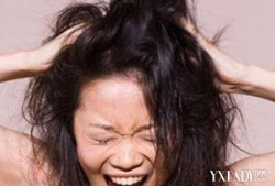 孕妇鼻子老发干上火怎么办,孕期头发干枯毛躁怎么回事