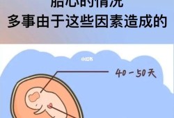 胎儿没胎心怎么办（胎儿没胎心是怎么回事）