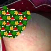 哺乳期乳房很痒怎么回事呢,孕期乳房痒是怎么回事