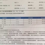 孕期dna检查（孕期dna检查几周做最好）