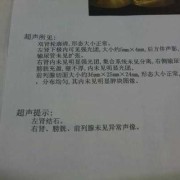 胎儿左肾集合部分离（胎儿左肾集合部分离）